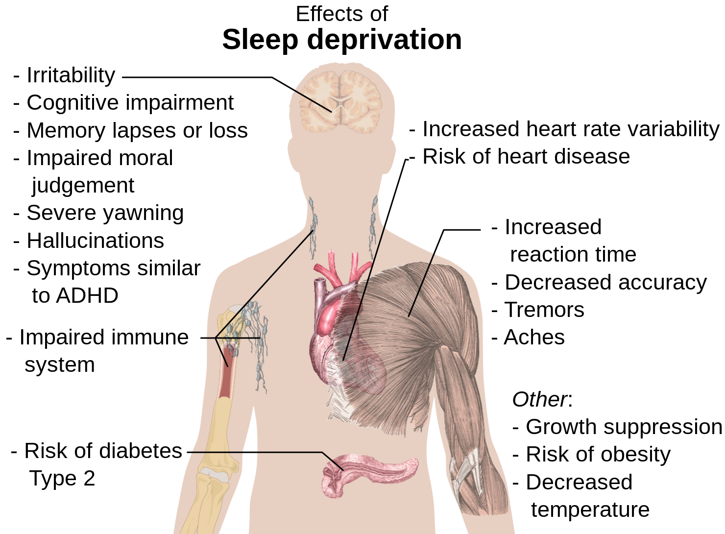 New deprivation - Psychology, Experiment, Deprivation, , Longpost