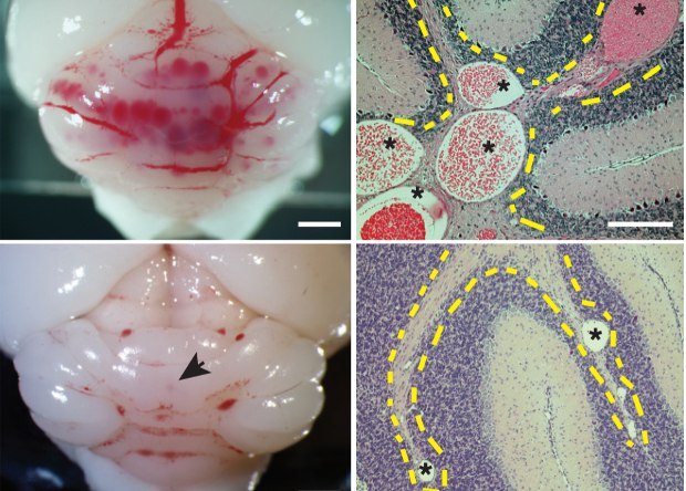 Gut microbiota is capable of causing stroke - The science, news, Brain, The medicine, Intestinal microflora