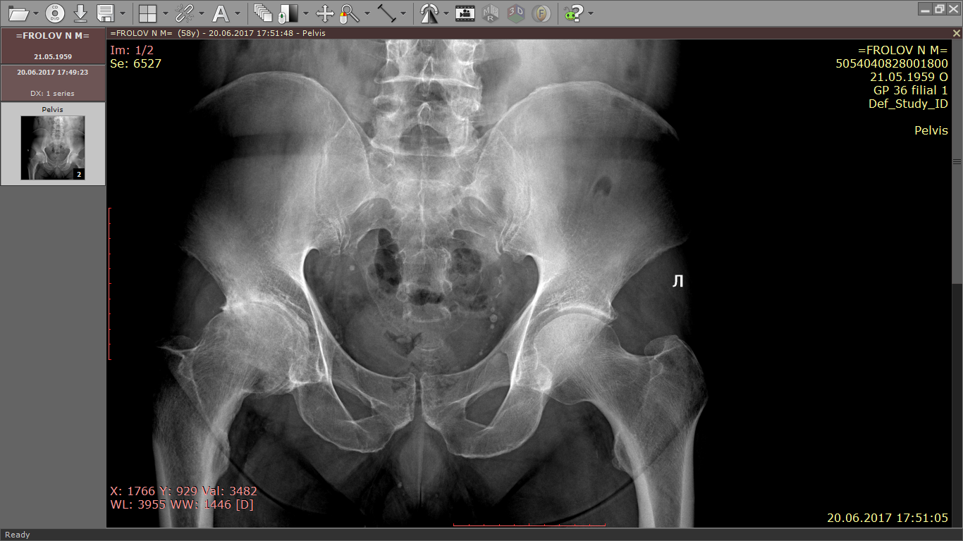 Should I change the joint? - Doctors, Orthopedists, Joints, Operation