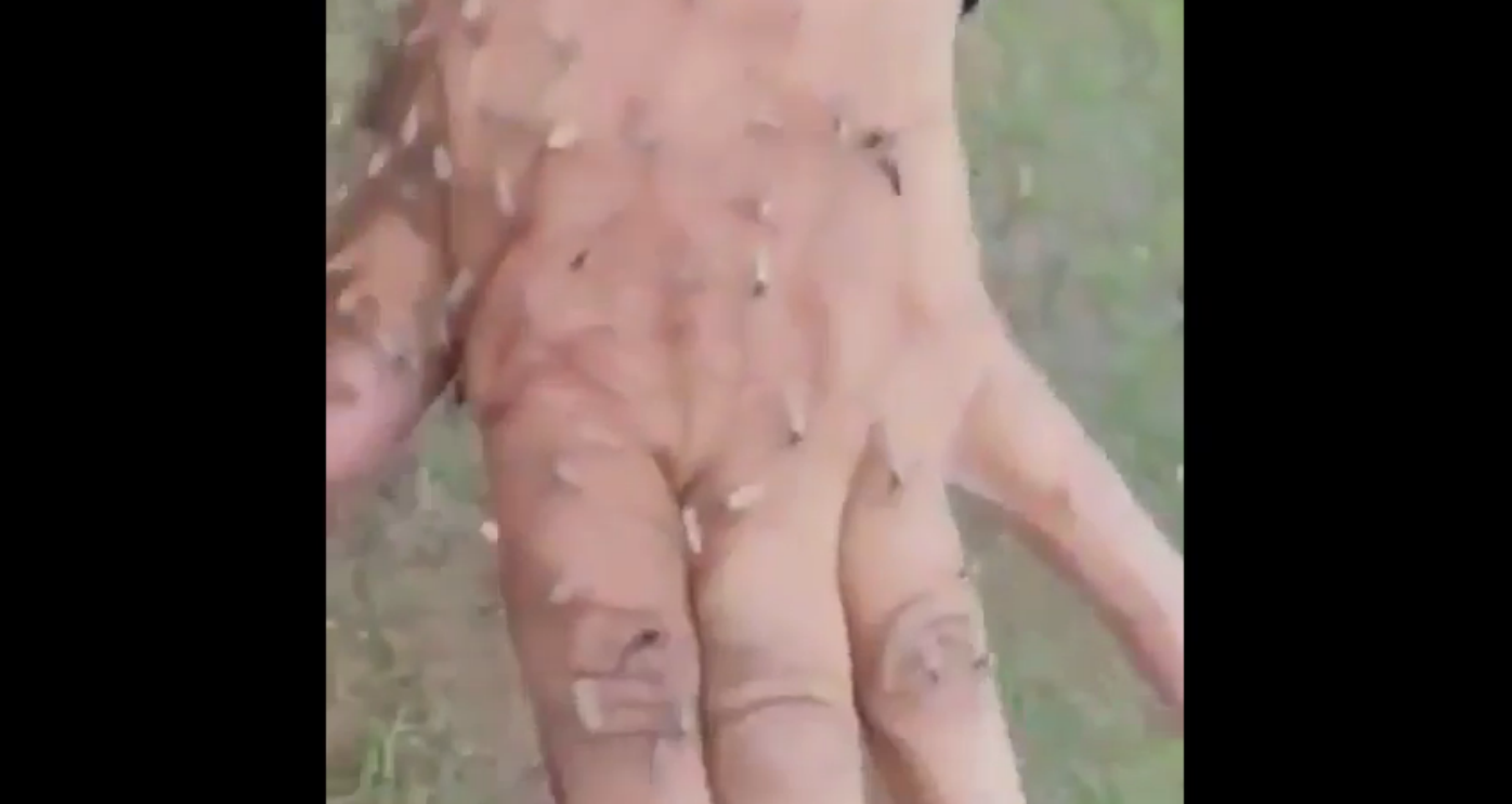 Mosquitoes in Yakutia - Yakutia, Mosquitoes, Video