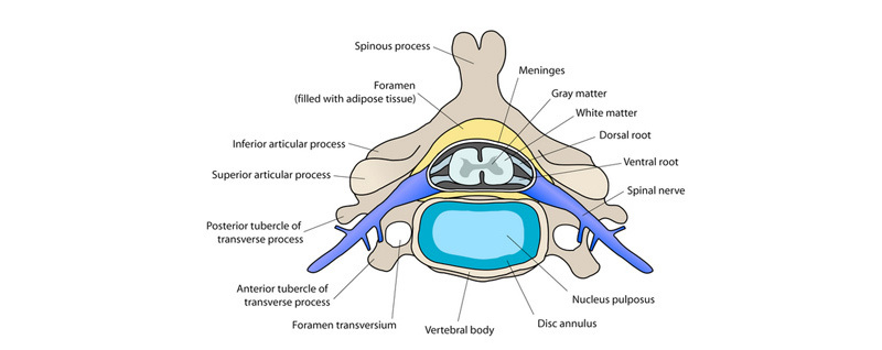 A little about the health of the spine and proper posture - My, Fitness, Exercises, Posture, Back, Spine, , Hernia, Longpost