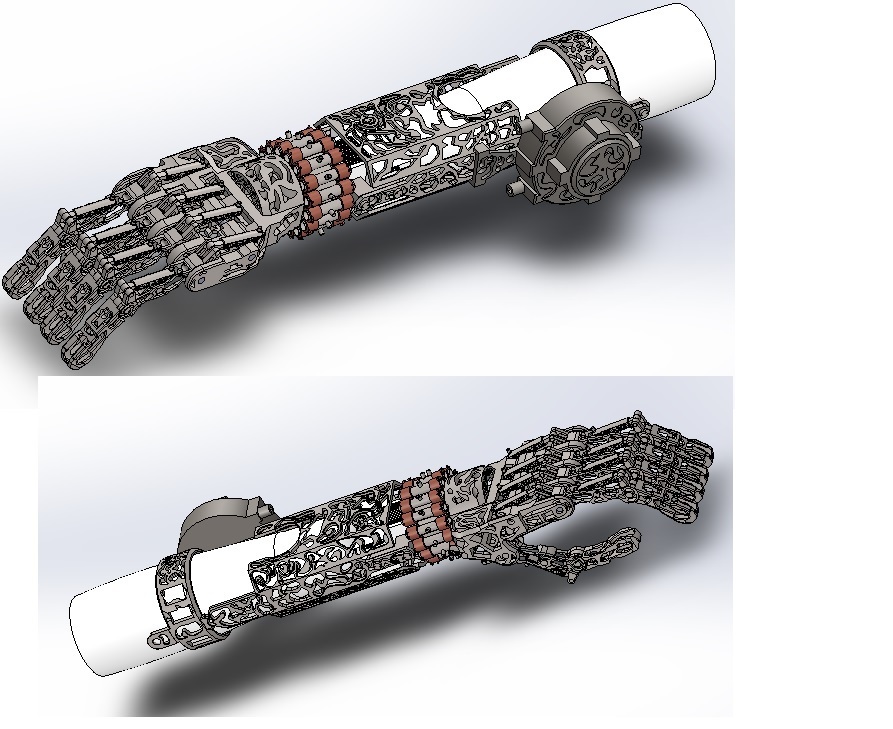 The story of the titanium hand - My, Prosthesis, Diploma, Uhf SR, Longpost