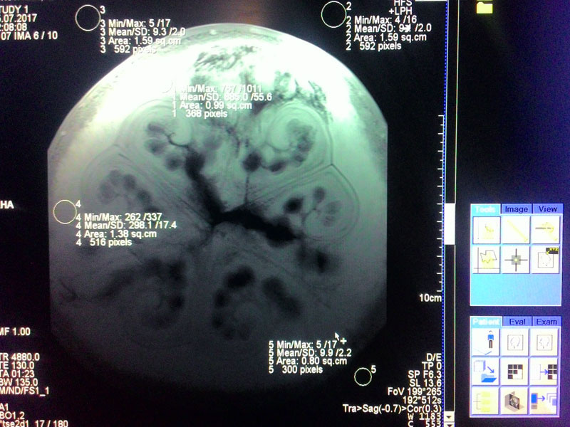 How to determine the ripeness of a watermelon? - Watermelon, MRI, Summer is coming, Geektimes