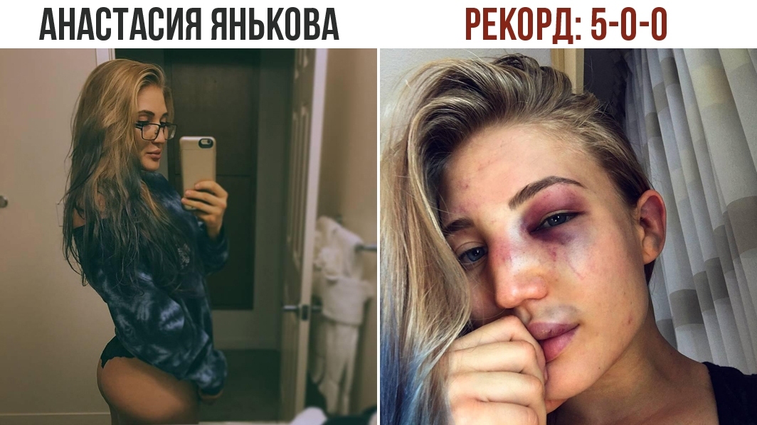 Анастасия янькова фото до боя и после