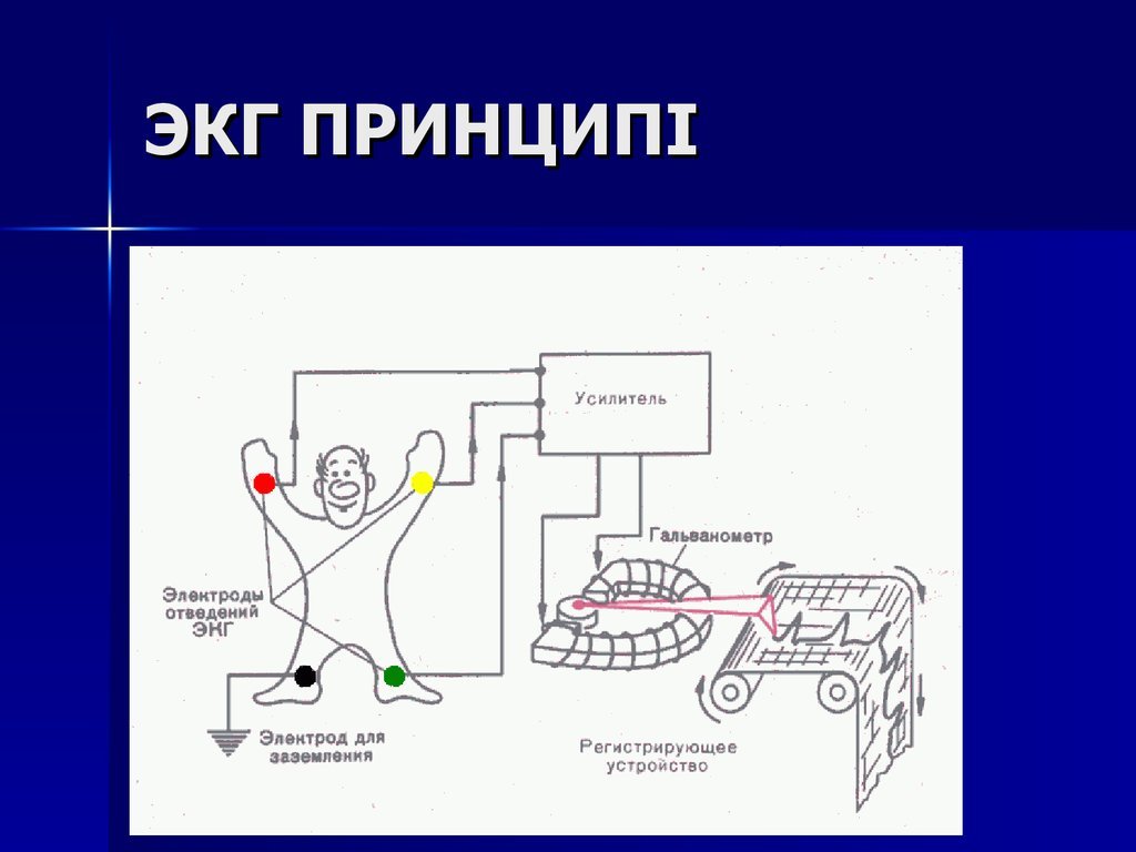 Я - медтехник. Калибровка кардиографа | Пикабу