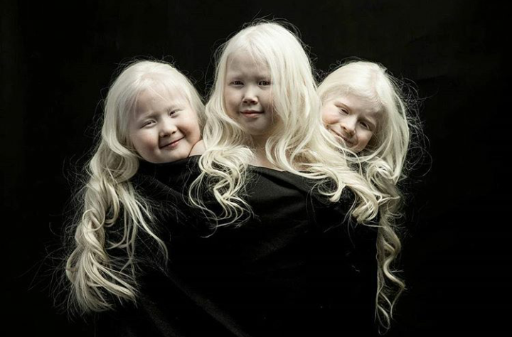 albino children - Yakutia, Children, Albino, Copy-paste, Longpost