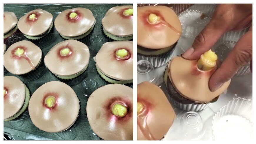 Pimple cupcakes - Yummy, Om-Nom-nom, Acne, Ugh