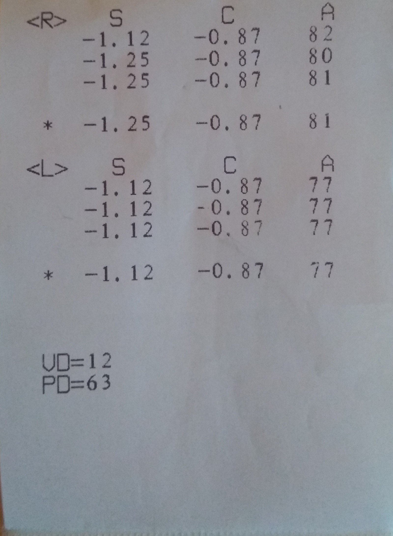 Help of ophthalmologists - My, Vision, Optics, Glasses, Help