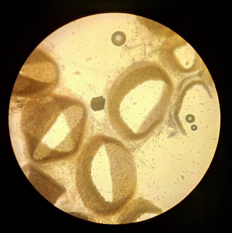 Споры белого гриба под микроскопом
