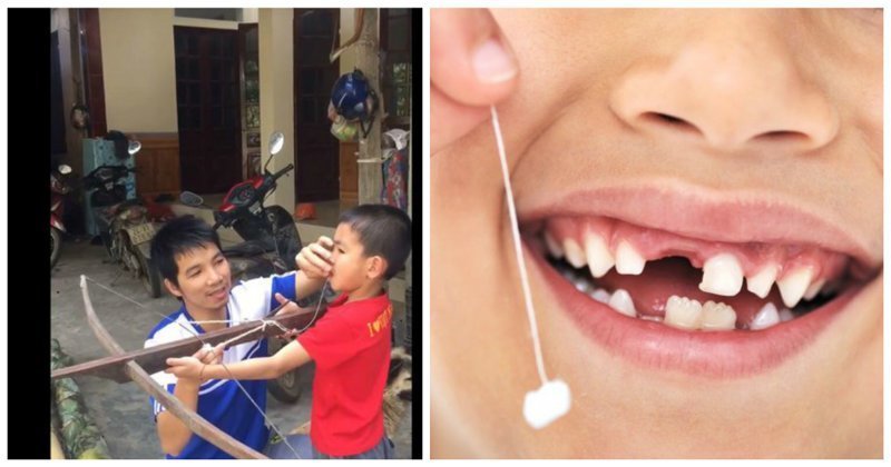 A Vietnamese man removed his son's tooth with a crossbow. - Trash, Dentistry, Vietnam, Crossbow, news, Video, Trash