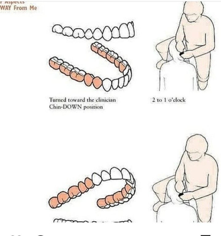 The position of the dentist during work - Pose, Dentist, Dentist