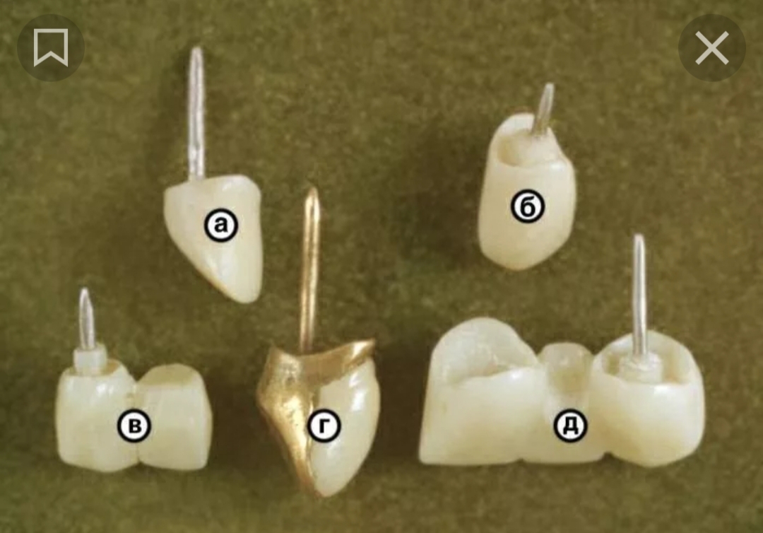Проглотила коронку, не простую, золотую, ах если бы, со штифтом | Пикабу