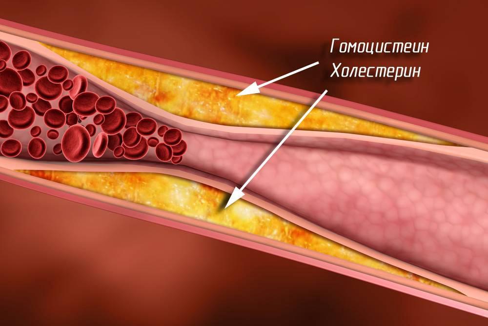 Analyzes. Proteins and amino acids in the blood. - My, , Medical tests, Analysis, , , , , Albumin, Video, Longpost