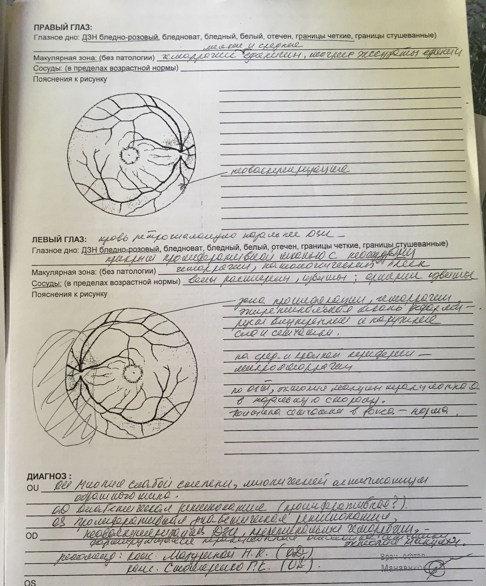 Ophthalmologists, surgeons (diabetologists) - need your opinion, please - My, Eyes, Surgery, Diabetes, Help, Operation, Longpost