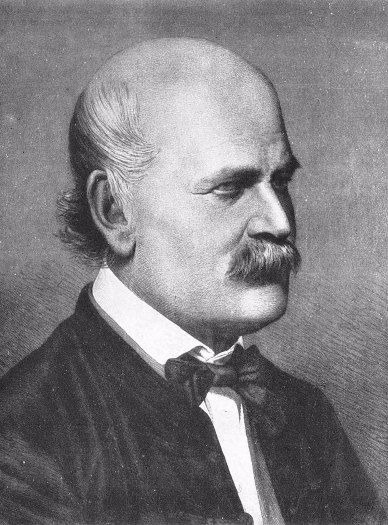 Childbirth fever - the scourge of the 19th century [History of Medicine] - My, The medicine, Story, Disease, Surgery, Antiseptic, Ignaz Semmelweis, Pasteur, , Video, Longpost