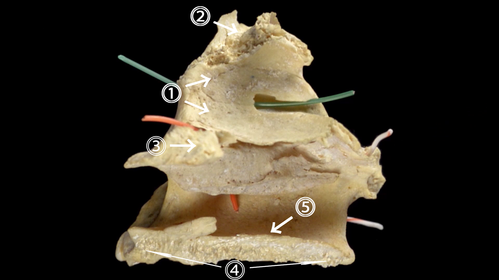 Upper jaw. human anatomy - My, Anatomy, , Video, Longpost