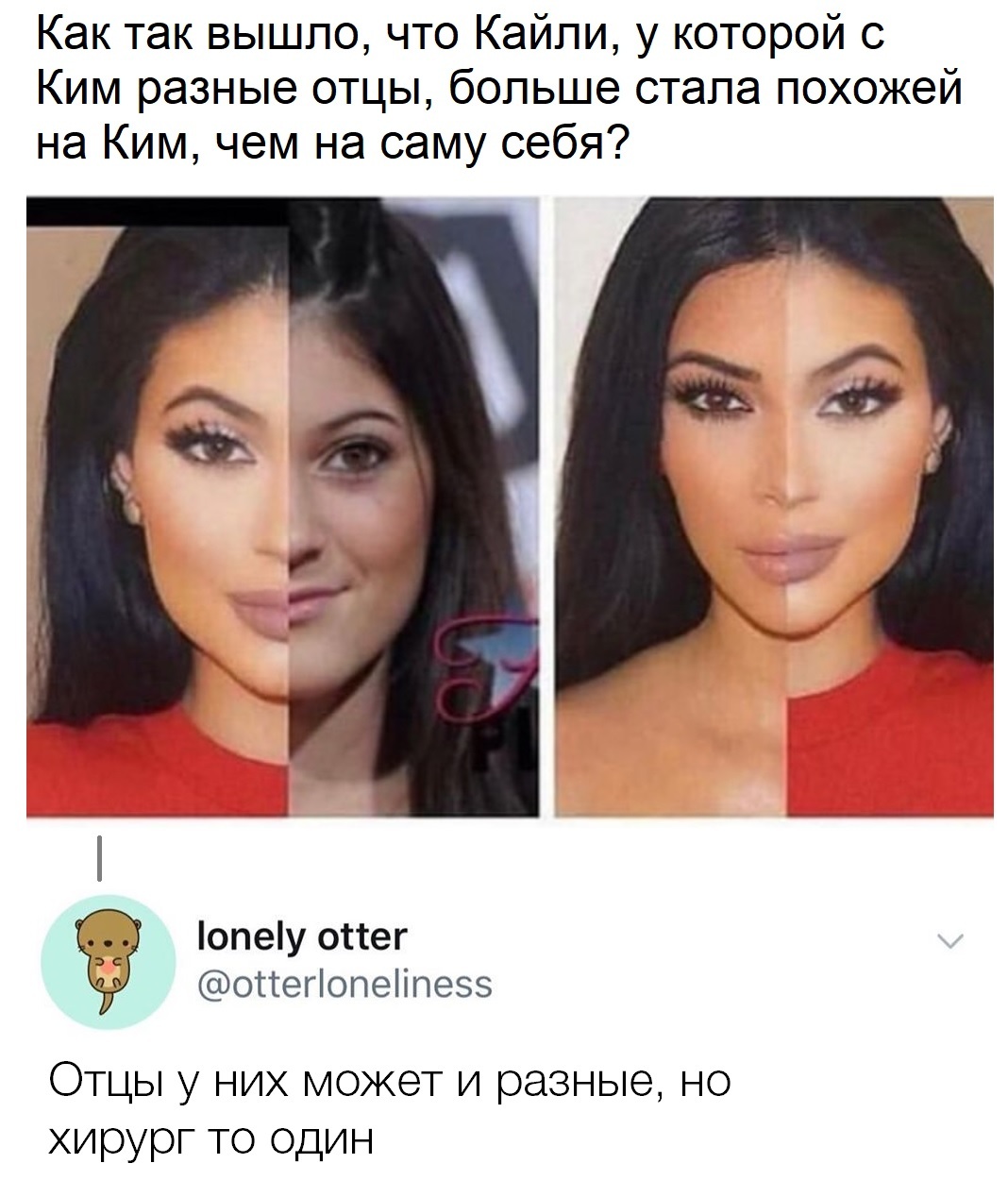 Ким кардашьян до и после пластики
