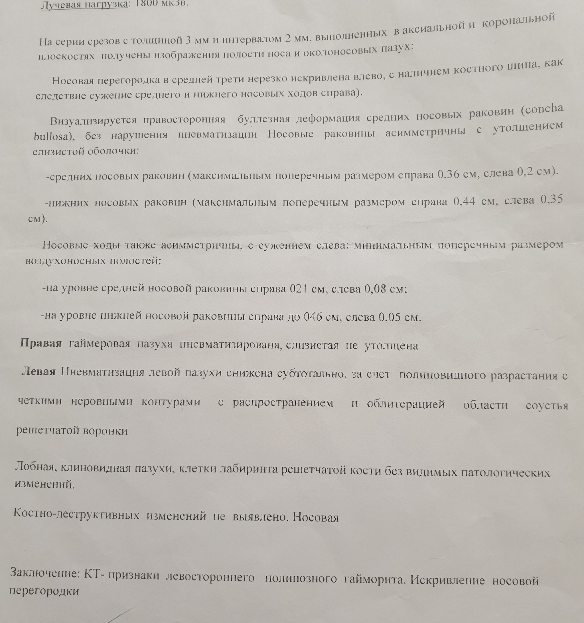 А может просто не стоило или моя подруга - Моё, Длиннопост, Гайморит, Гайморотомия, Подруга