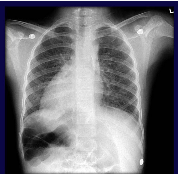 What's wrong? - My, X-ray, X-rays, The medicine, Diagnosis, Need a diagnosis