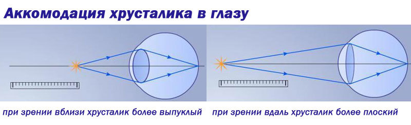 Laser vision correction - Ophthalmology, Eyes, Laser correction, Operation, Longpost