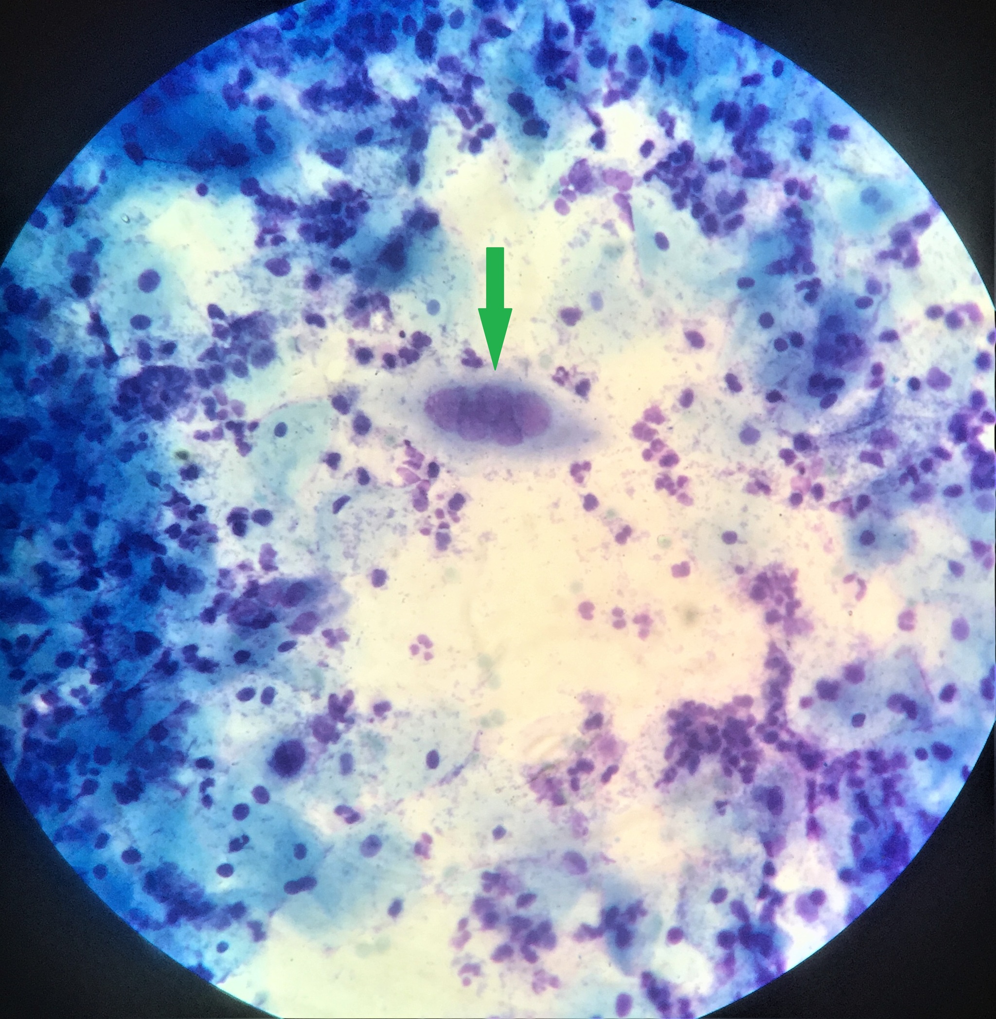 Laboratory diagnostics. Microscopy - My, Laboratory, Diagnostics, Microscope, Microscopy, Analysis, Herpes, Virus, Longpost