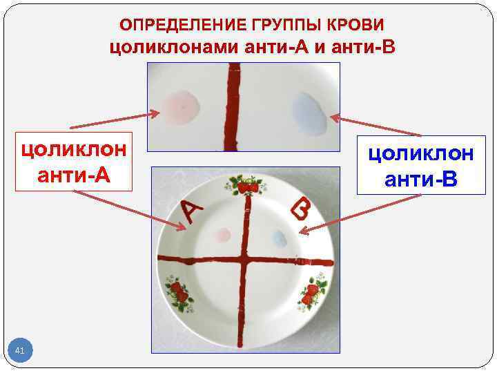 Determination of blood groups in the laboratory - My, Blood test, Blood type, Laboratory, The medicine, Longpost, Analysis