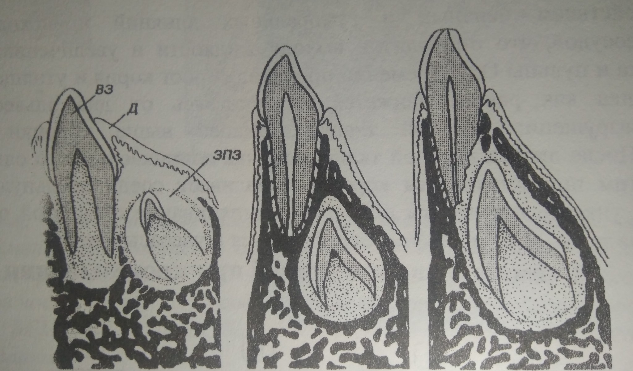 No. 12. Do baby teeth need to be treated? - My, Longpost, Dentistry, Dentist, Teeth, Baby teeth, Children