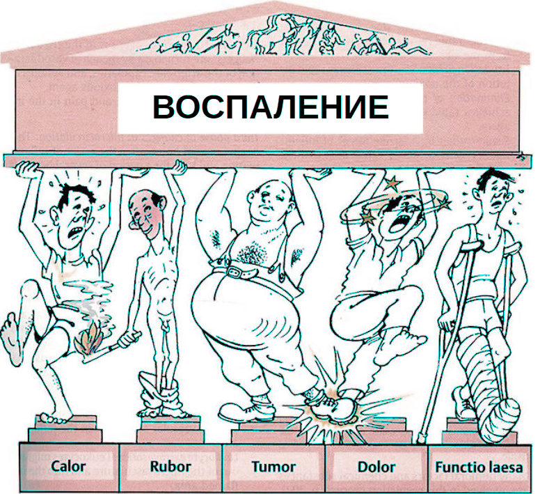 Наши внутренние войска: Его Величество Воспаление - Моё, Иммунология, Иммунитет, Биология, Длиннопост