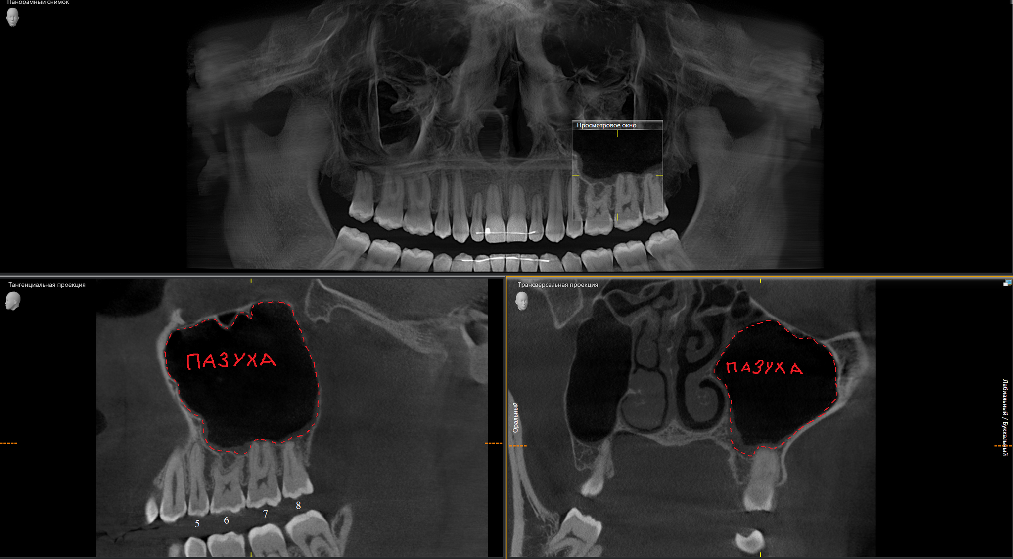 Recommendations after visiting a dental surgeon - My, Dentist, Dentistry, Surgeon, Surgery, Recommendations, Doctors, Teeth, The medicine, Mat, Longpost