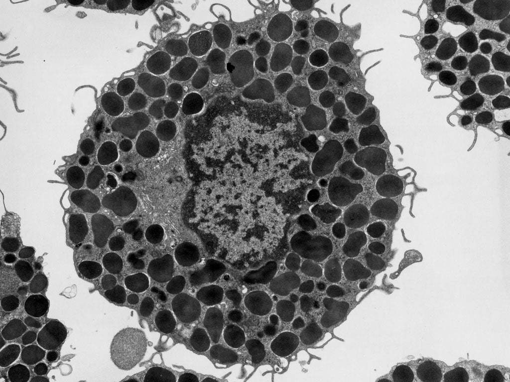Тельце гейнца. Тучная клетка микрофотография. Тучные клетки гистология. Тучная клетка Электронограмма. Тучные клетки Эрлиха микроскоп.