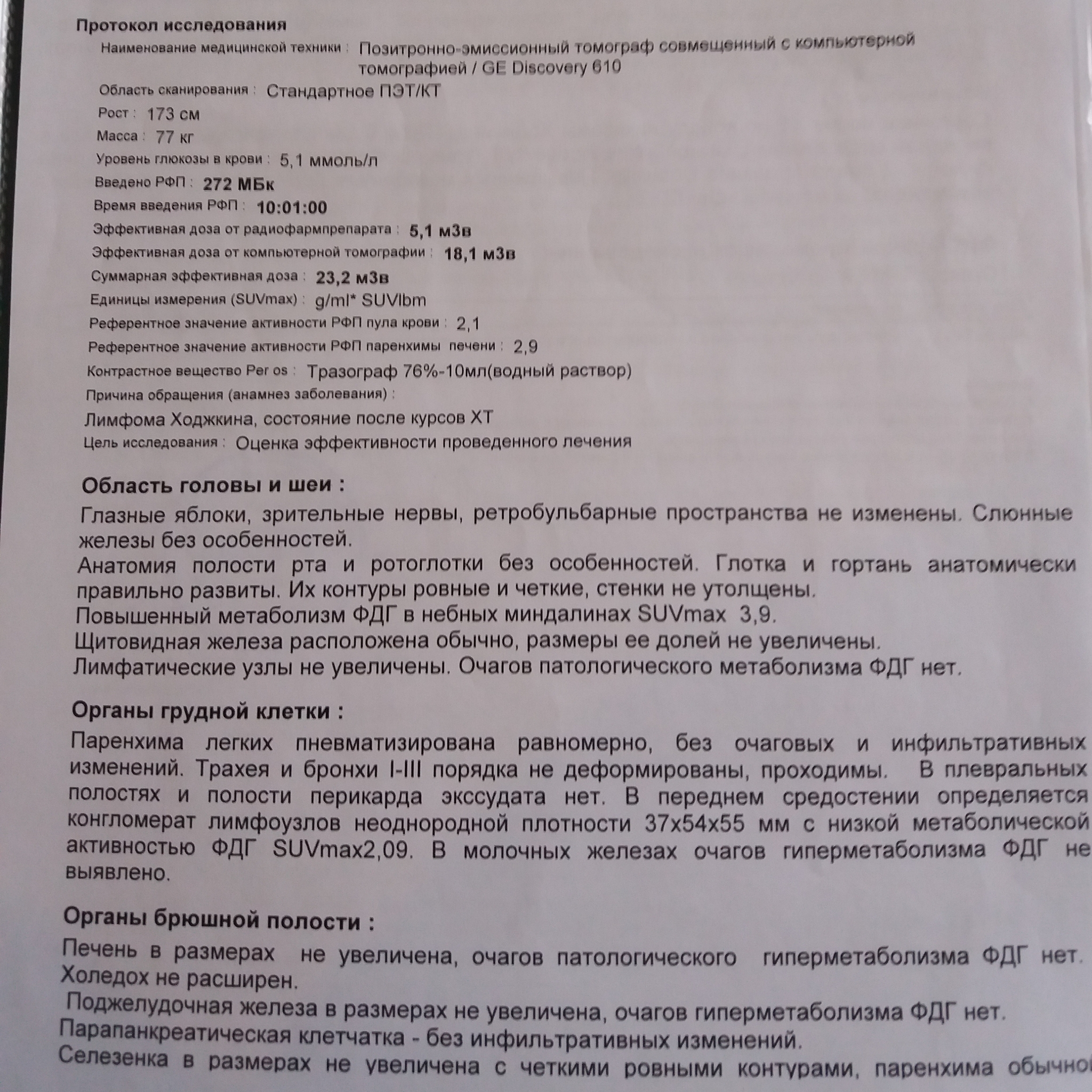 Иотги полугодовалого лечения от ходжкинской лимфомы - Моё, Рак и онкология, Лимфома, Лимфома Ходжкина, Болезнь, Лечение, Без рейтинга, Видео, Длиннопост