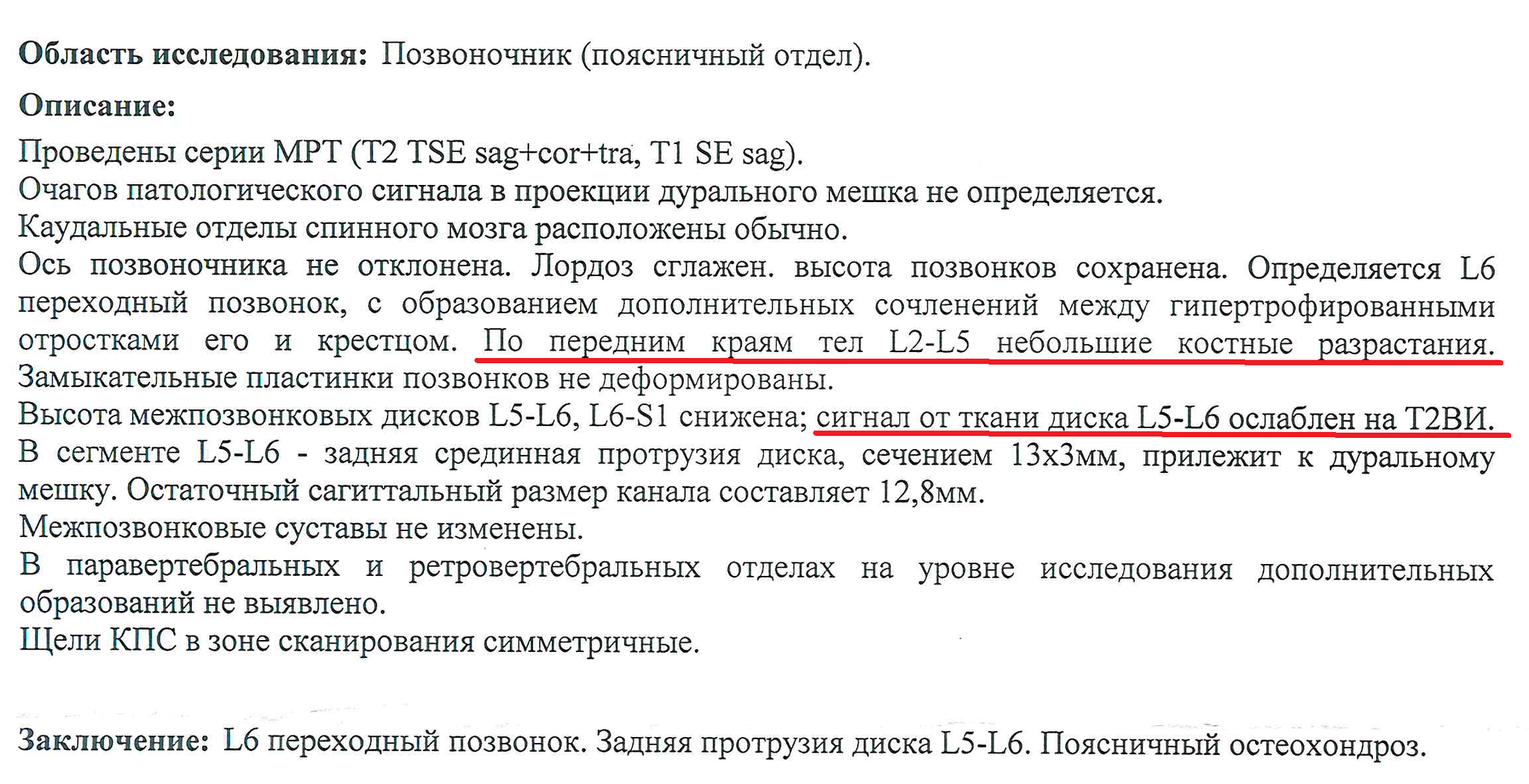 Свидетели остеохондроза поделитесь опытом | Пикабу