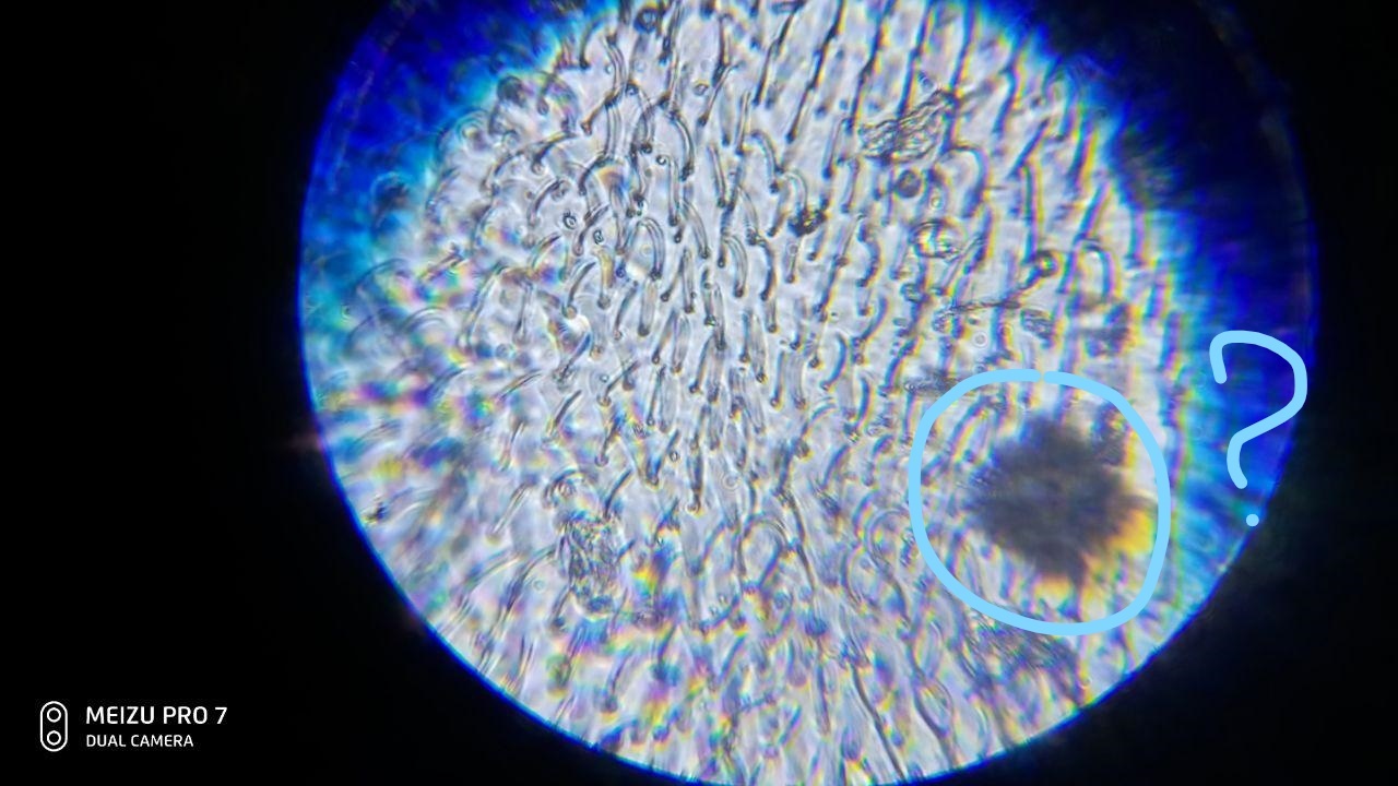 What kind of artifacts are there in a microscope? - My, Microscope, Help, Mystery, Optics, Microscopy, Vision