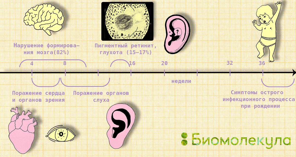 Нужна ли вакцинация от краснухи, если ее почти уже и нет? - Вакцина, Краснуха, Вакцинация, Здоровье, Беременность, Длиннопост