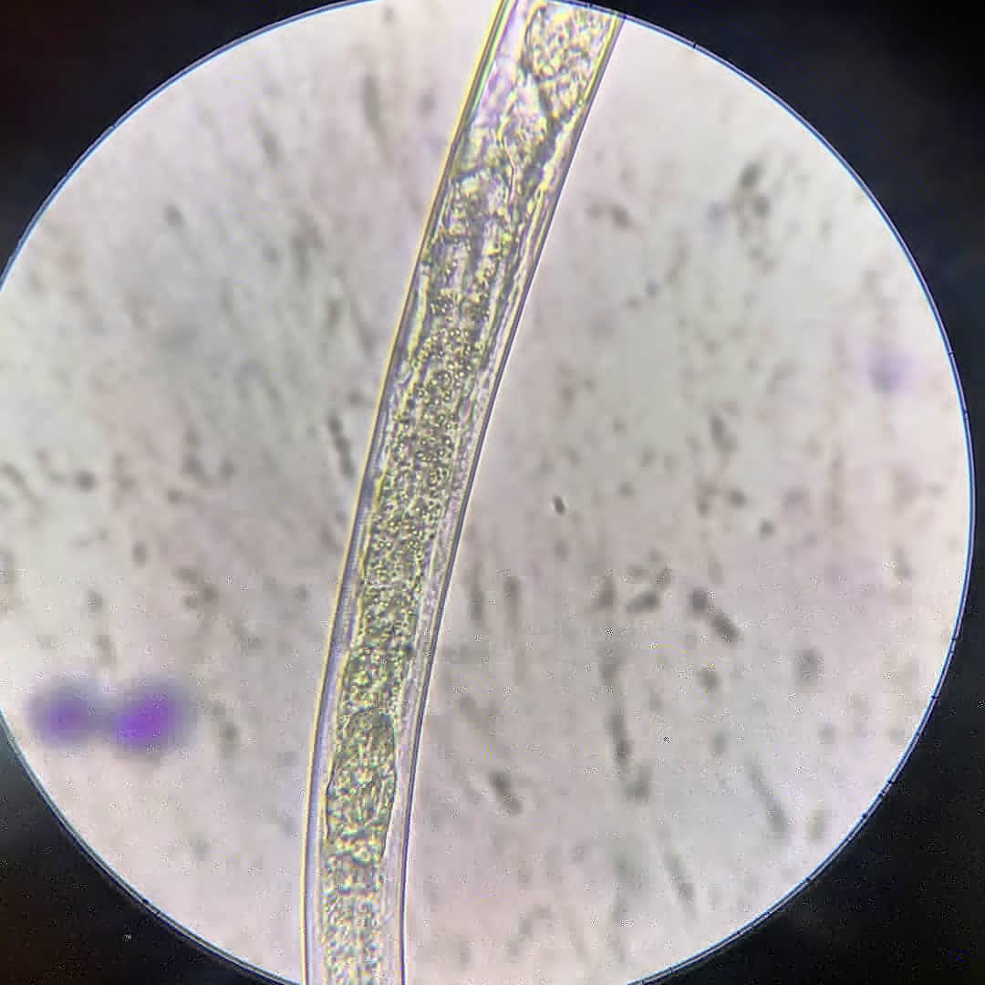 Невидимая жизнь рядом с нами - Моё, Микроскоп, Микробиология, Глисты, Микробы, Видео, Длиннопост
