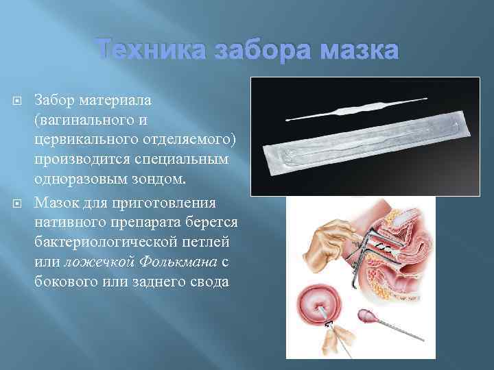 Пластика входа во влагалище (кольпорафия, вагинопластика) - цена операции в ЮНИОН КЛИНИК