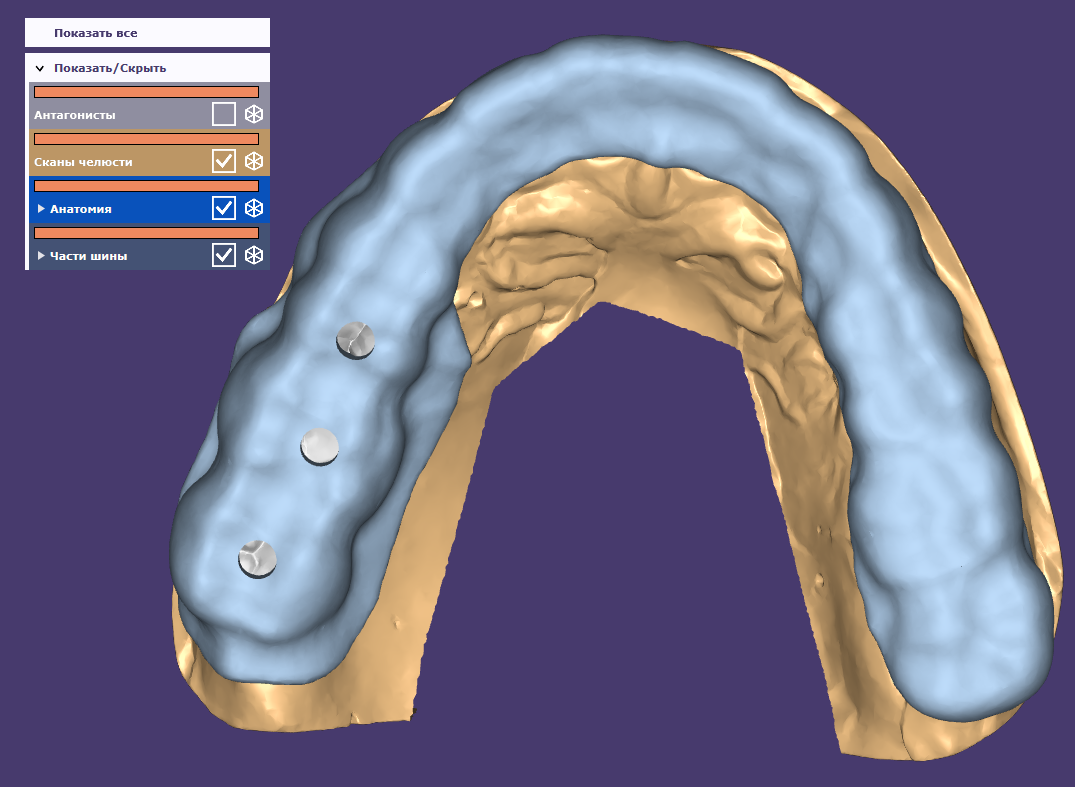 Dentistry: expectation and reality - My, Dentist, Dentistry, Surgeon, Doctors, Teeth, Dental implantation, The medicine, Doctor, Longpost