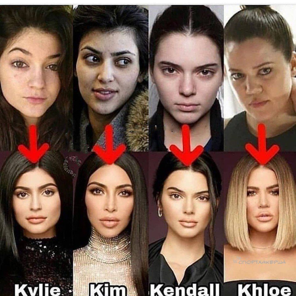 Kardashian sisters - Plastic surgery, Kardashians, It Was-It Was, Fearfully