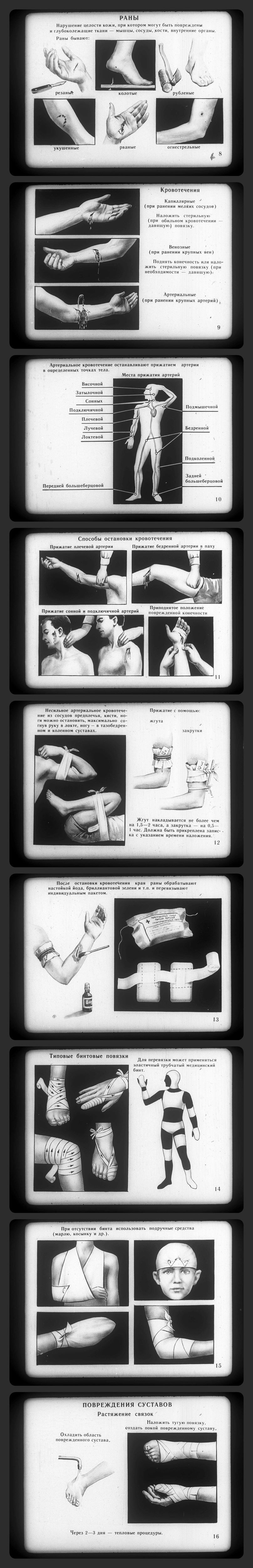 First aid in case of accidents - the USSR, Longpost, Past, Picture with text, Filmstrips, Accident