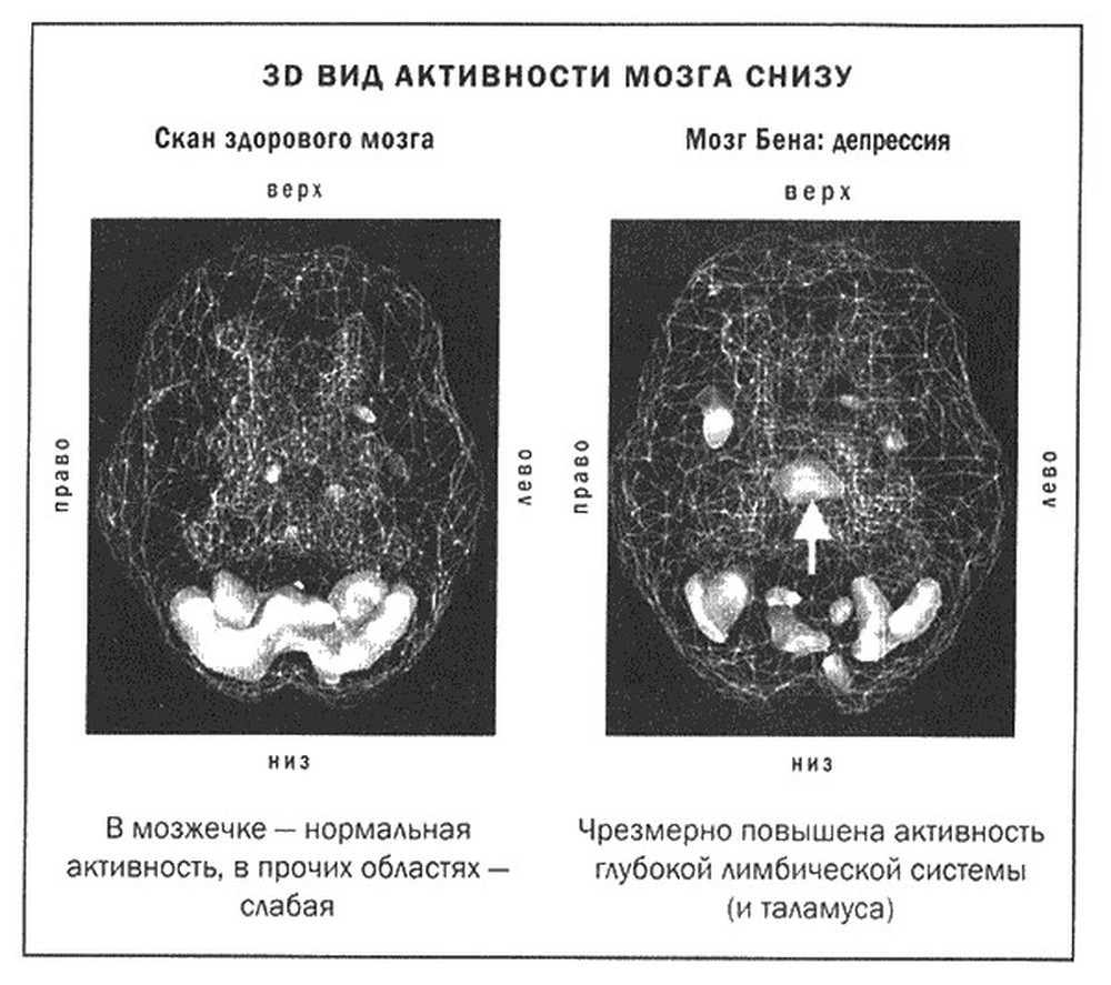 10% of the brain. Again 2 - Myths, Brain, Brain Development, Video, Longpost