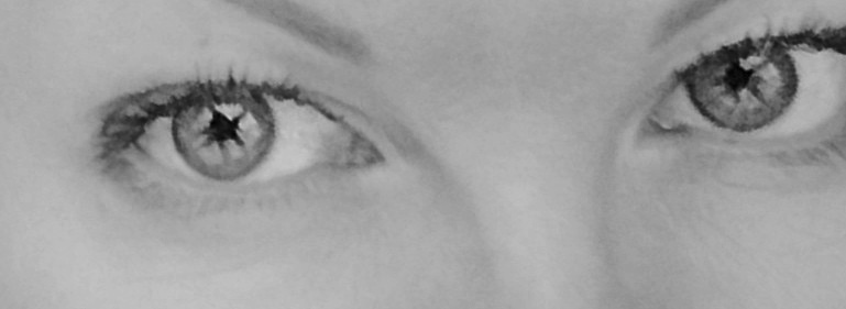 A New Look - My, Cataract, Eyes, Sight, Disease
