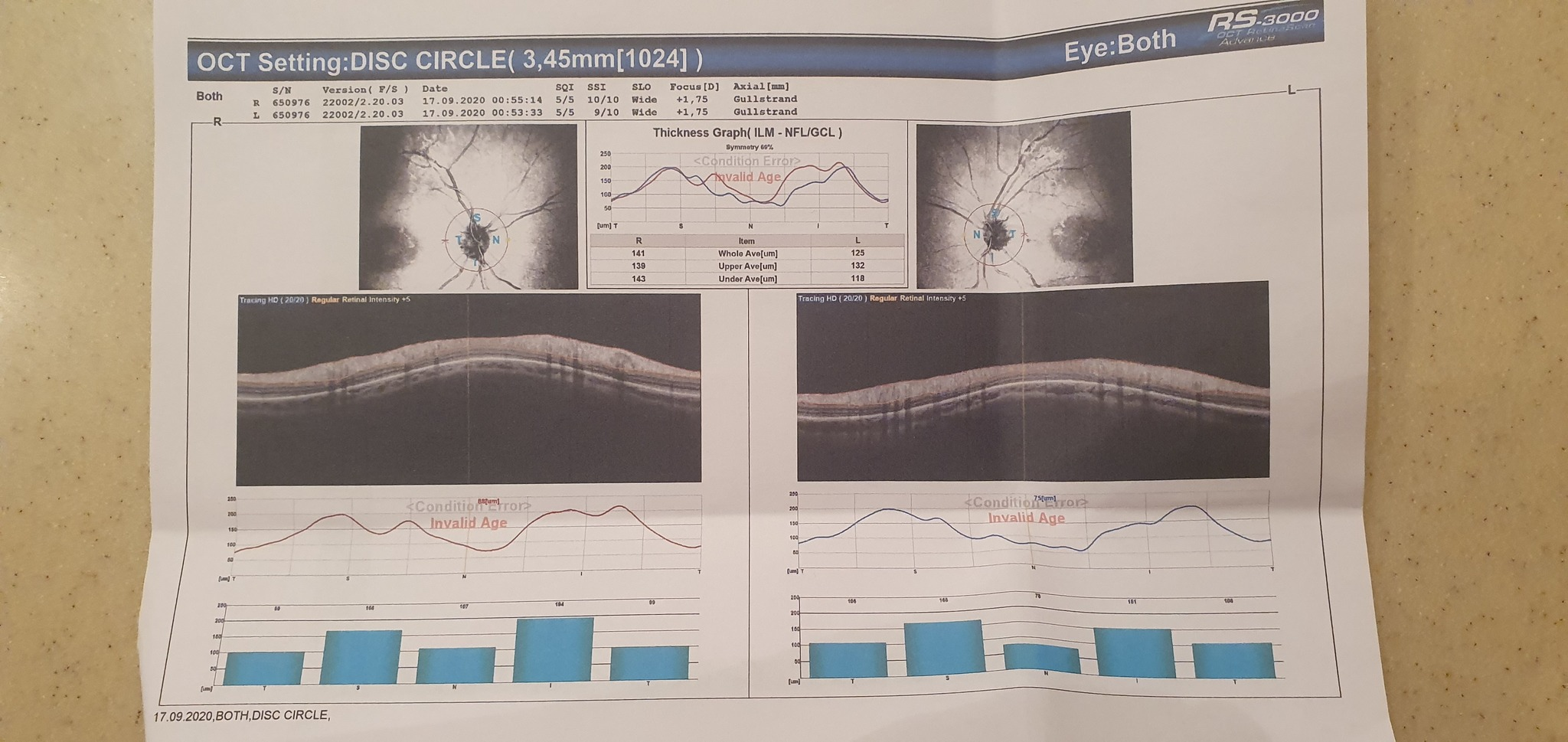 Need advice or help from an ophthalmologist - My, No rating, Help, Doctors, Text, Longpost