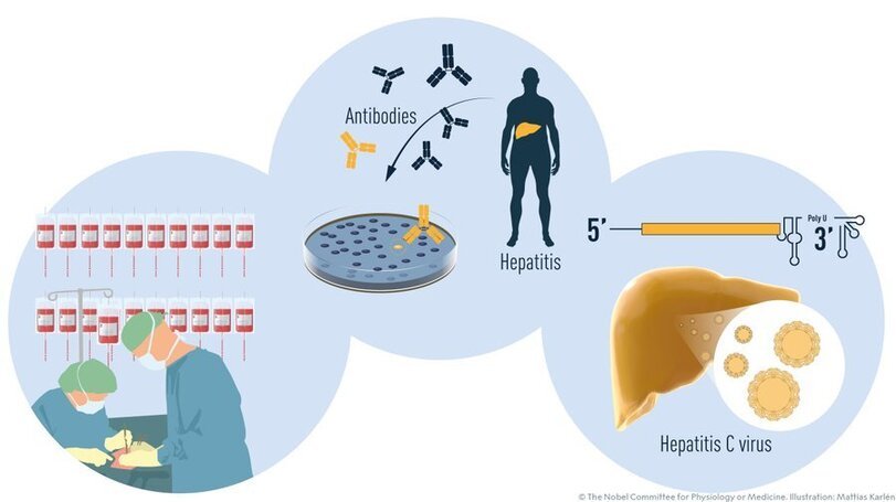 Good news this year - Nobel Prize, Hepatitis C, Longpost, The medicine, Hepatitis