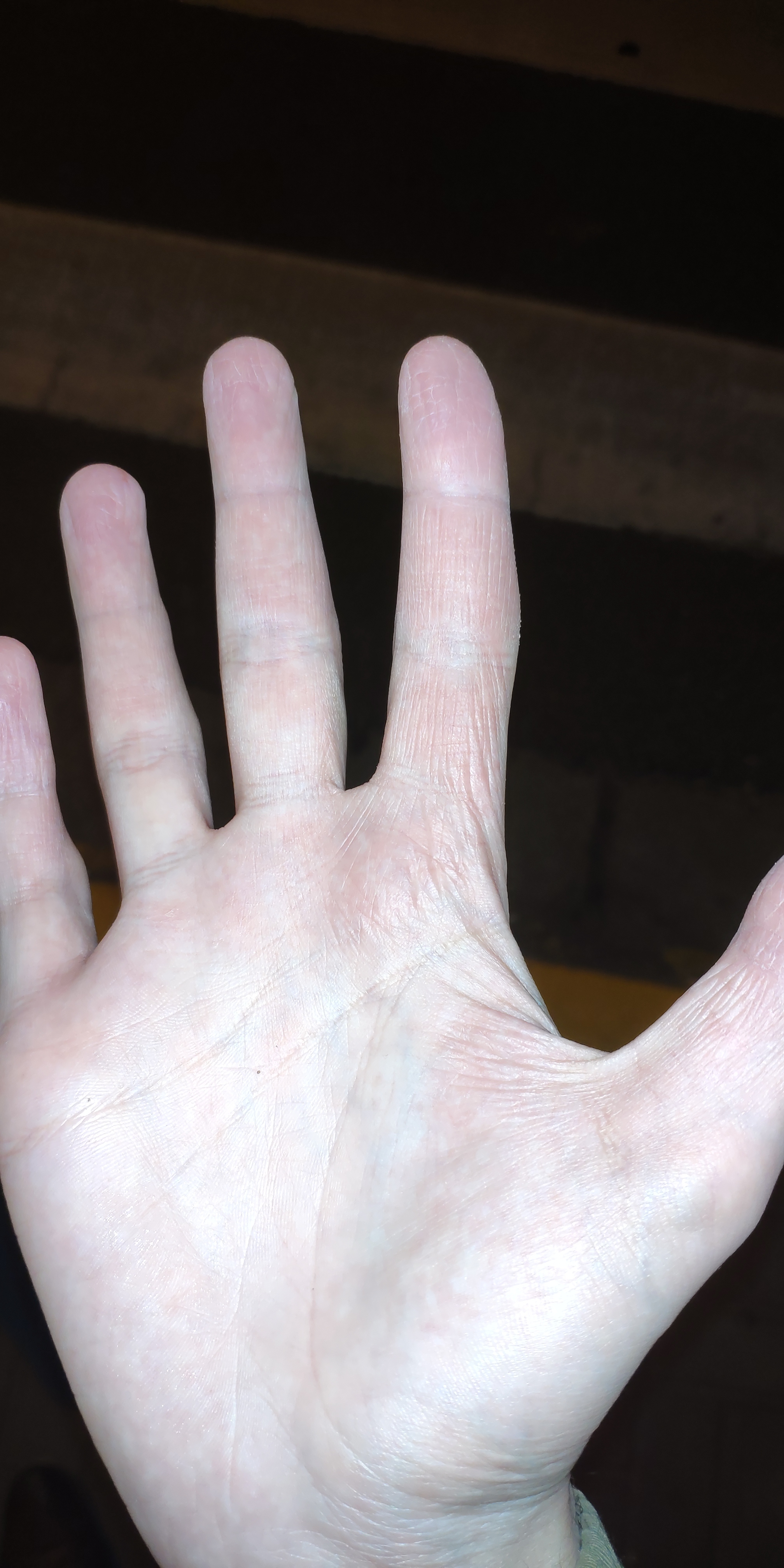 Problem with hands - Disease, No rating, Doctors, Longpost