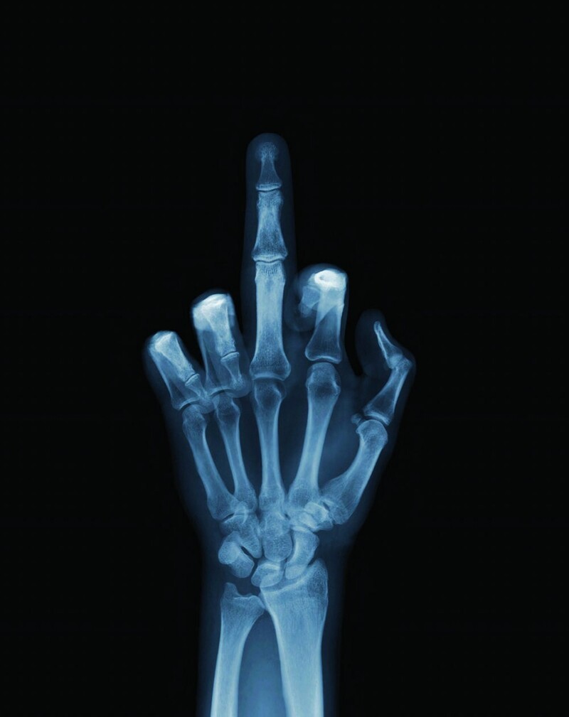 8 ноября 1895 года, 125 лет назад, физик Вильгельм Рентген открыл « рентгеновские лучи» | Пикабу
